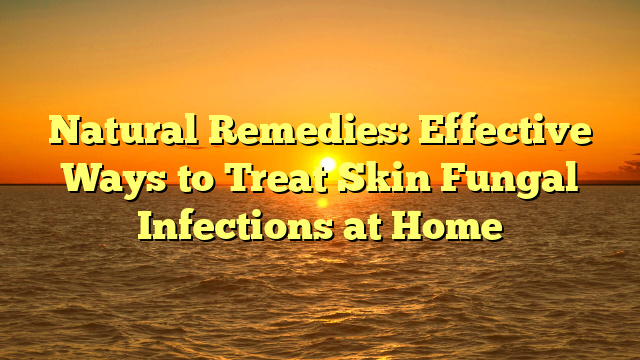 Natural Remedies: Effective Ways to Treat Skin Fungal Infections at Home
